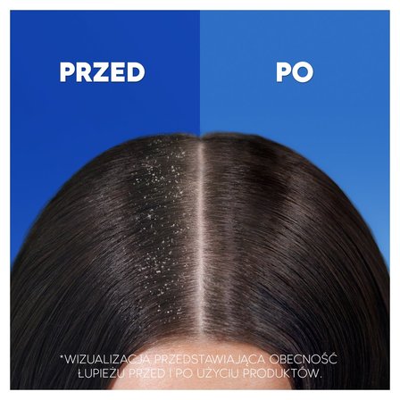 head & shoulders apple fresh szampon przeciwłupieżowy 400