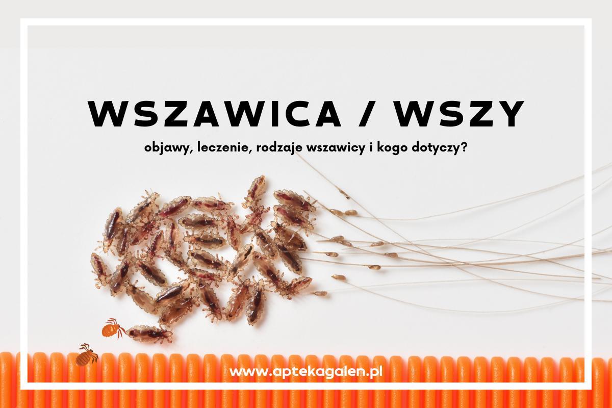 czy jak sie nalozy od wszy szampon to swedzi glowa