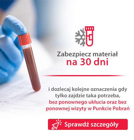 posiwe kału z pieluchy dziecka skuteczność