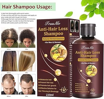 prevent hair loss szampon